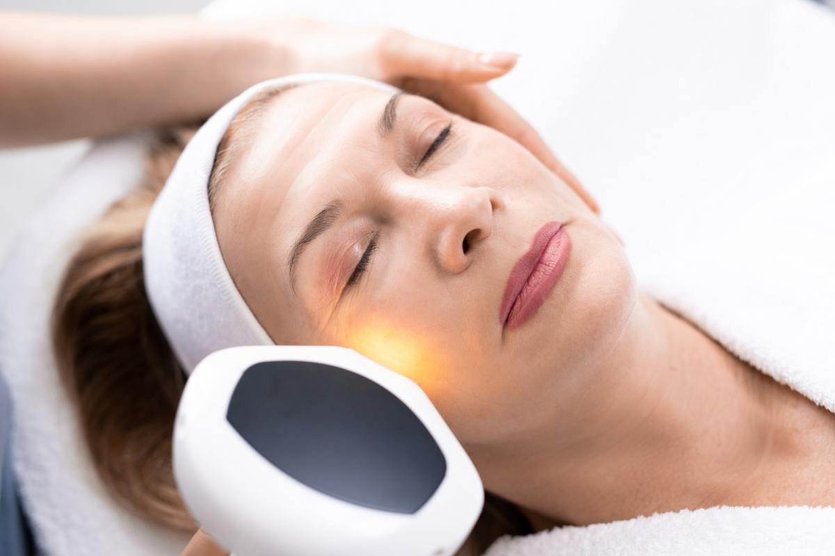 Laser skin resurfacing treatment at Harmony Healing Arts in Stuart, Iowa